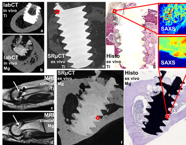 Decorative image; Third-party funded project MDLMA; this project aims to optimize biodegradable Mg-based implants by analyzing vast multimodal biomedical image data