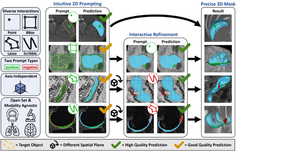 nnInteractive: A Breakthrough in AI-Driven 3D Interactive Segmentation ...