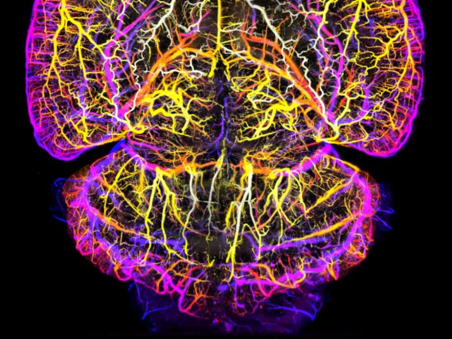 Helmholtz Imaging Project FOMIA, brain