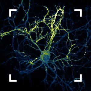 Decorative visual; Helmholtz Imaging Best Scientific Contest 2025 Winning image