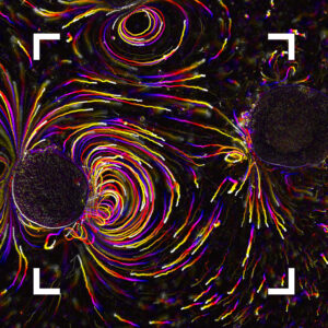 Decorative visual; Helmholtz Imaging Best Scientific Contest 2025 Winning image