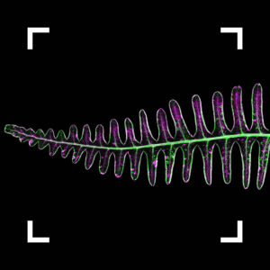 Decorative visual; Helmholtz Imaging Best Scientific Contest 2025 Winning image
