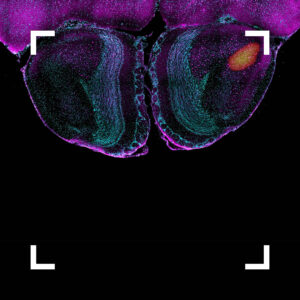 Decorative visual; Helmholtz Imaging Best Scientific Contest 2025 Winning image
