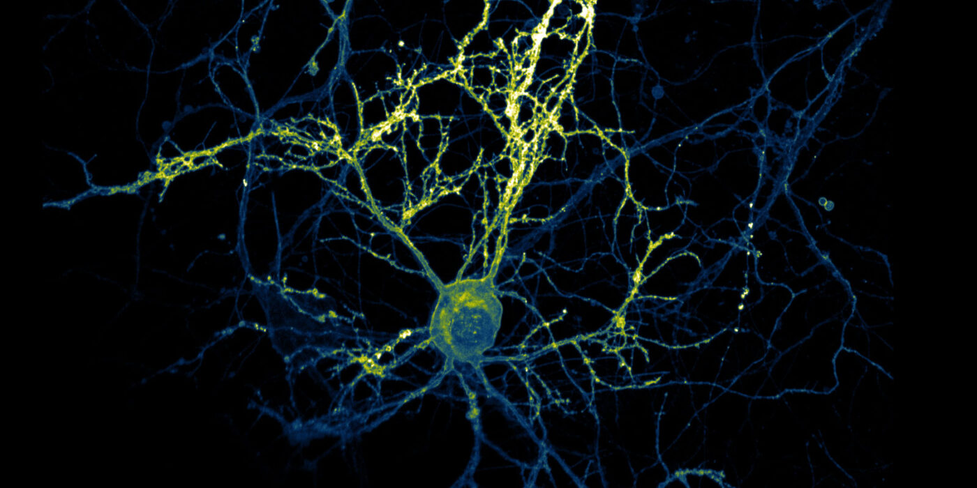 Decorative visual; Helmholtz Imaging Best Scientific Contest 2025 Winning image
