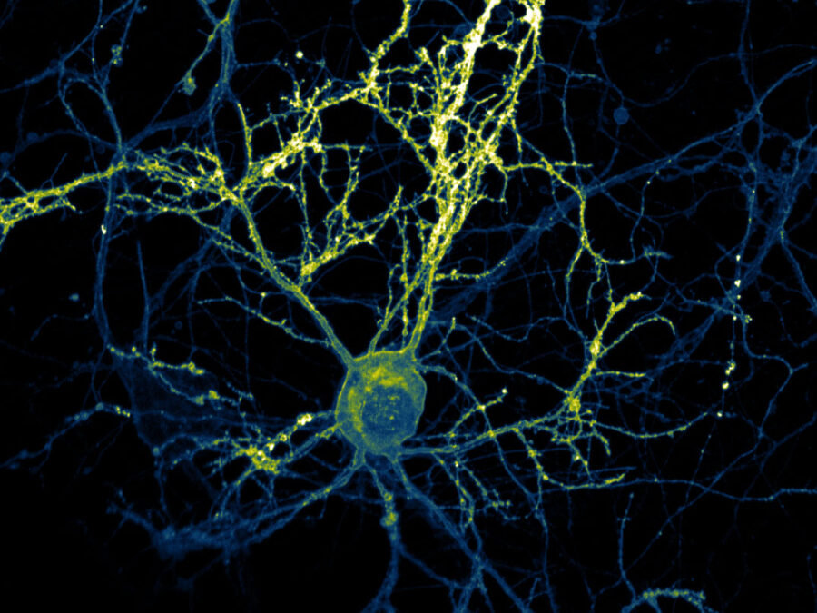 Decorative visual; Helmholtz Imaging Best Scientific Contest 2025 Winning image