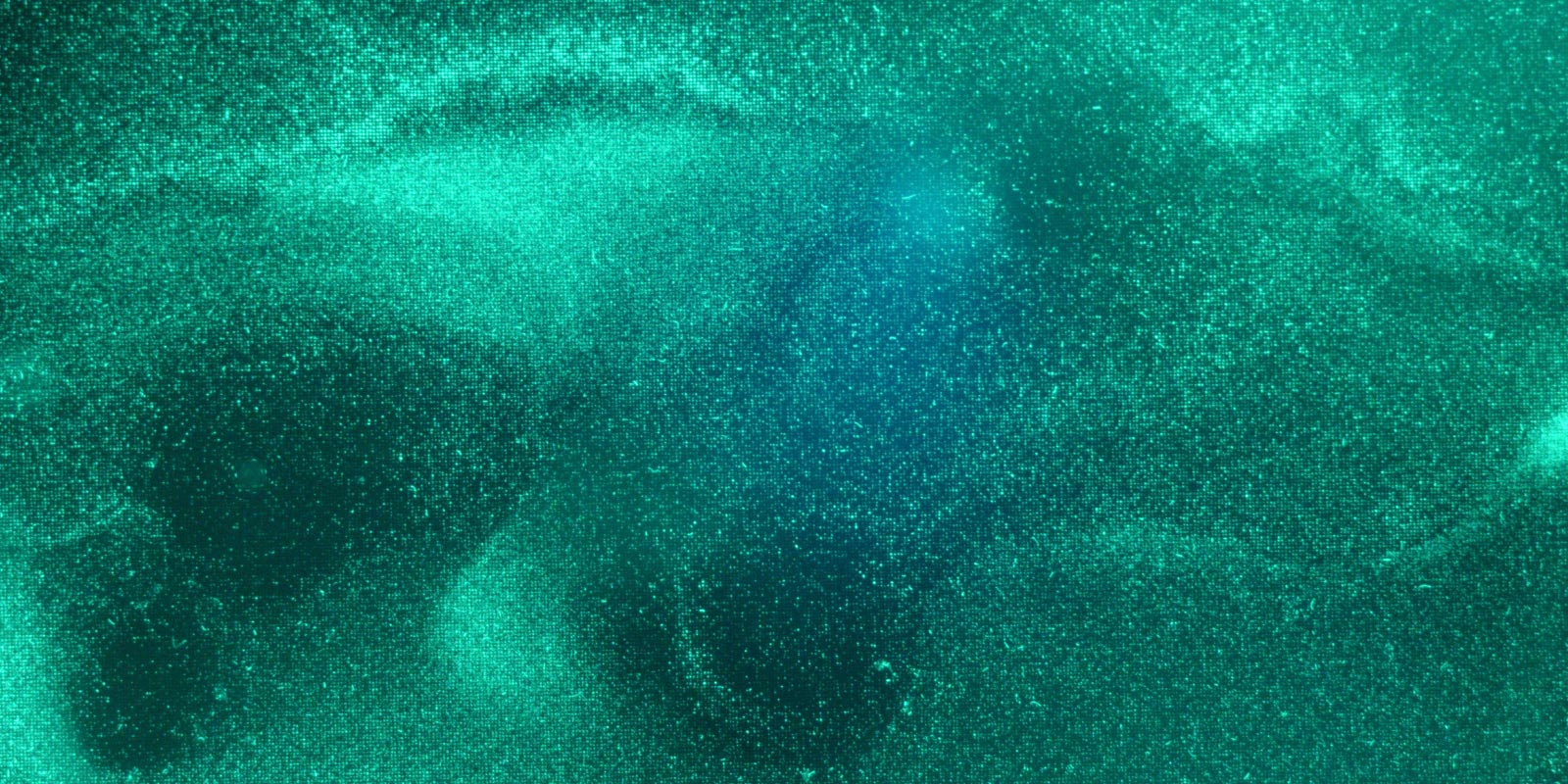 Fluorescent bacteria in cavities; image by Fabian Falk