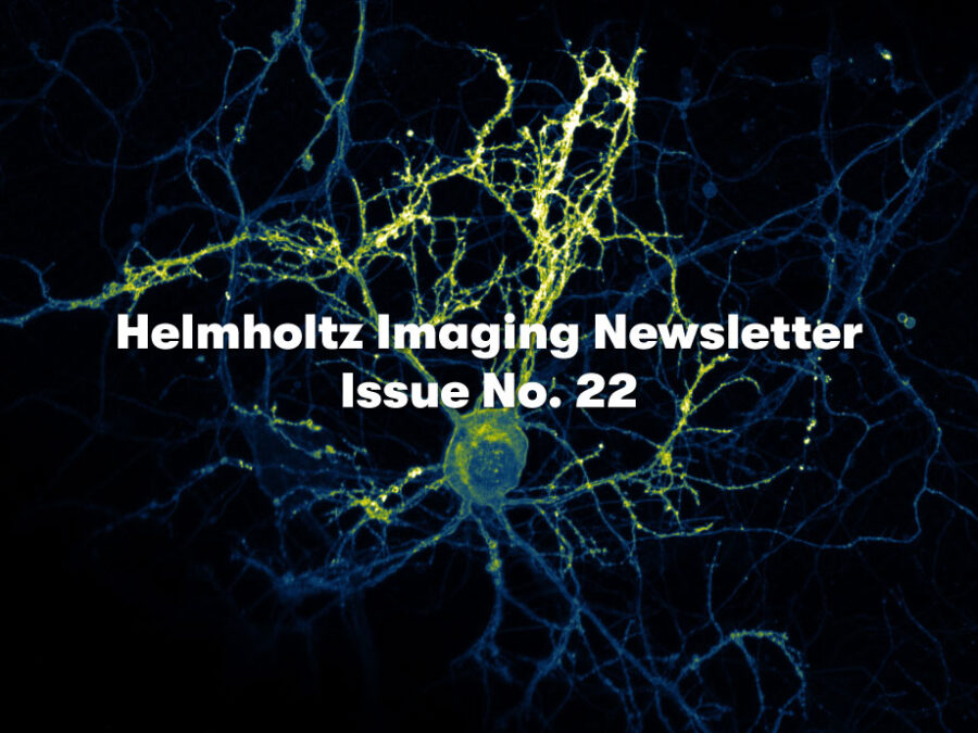 Visual to promote the Helmholtz Imaging Newsletter No. 22