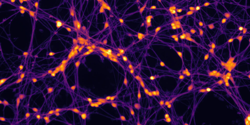 Within one week of growth, these human neuronal cells extend neurites and form new interconnections, illustrating their capacity to establish complex networks and vulnerability to disturbance.
