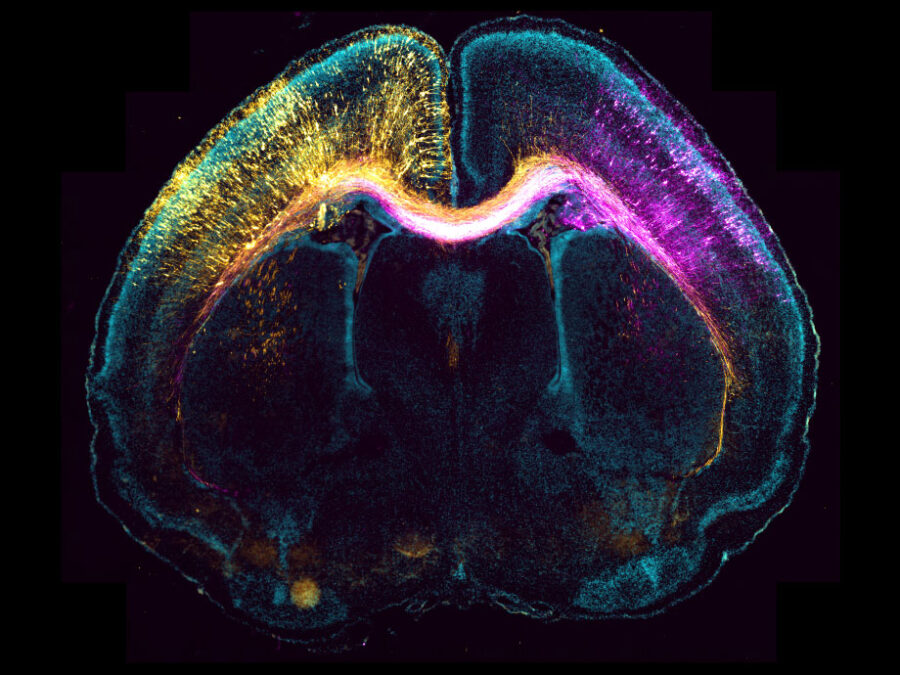BSIC 2023 contribution by Sebastian Dupraz (AG Bradke), DZNE; title: Stranger in the mirror