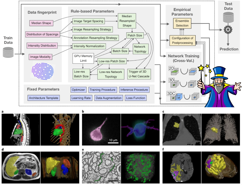 Visual of the nnU-Net
