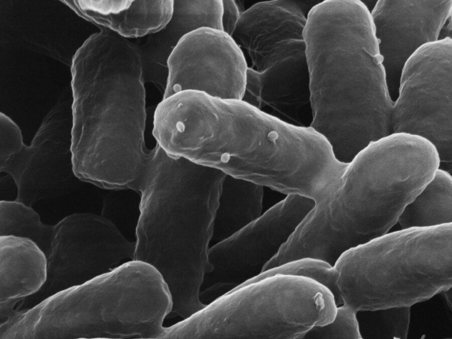 Image by L. Y. Wick, UFZ, called "Microbial viruses hitching a ride", showing phages that hitch a ride on motile bacteria that co-transport them to new environmental habitats (tube-shaped structures in black and grey colors).