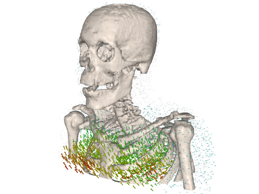 A 3D rendering of a human skeleton (skull, spine, ribs, and shoulders) with numerous colored vectors or arrows around the chest and rib cage indicating motion or force directions