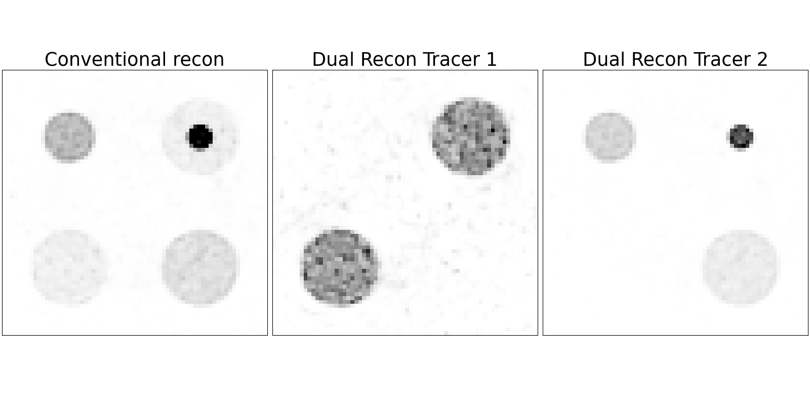 Comparison figure with three side-by-side grayscale image panels labeled “Conventional recon,” “Dual Recon Tracer 1,” and “Dual Recon Tracer 2.” Each panel contains circular shapes of varying size and intensity, illustrating differences in how the structures appear under the three reconstruction methods.