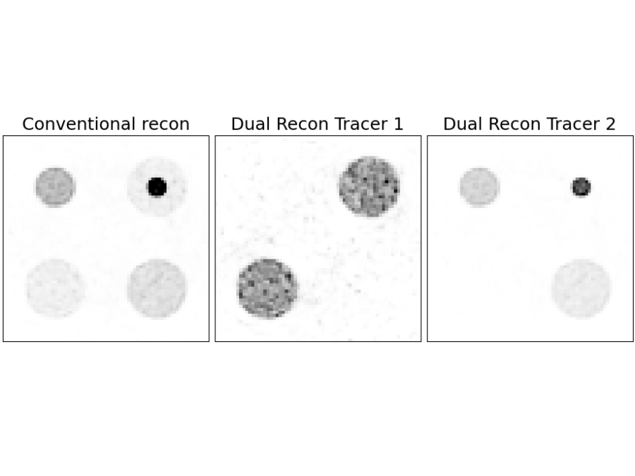 Comparison figure with three side-by-side grayscale image panels labeled “Conventional recon,” “Dual Recon Tracer 1,” and “Dual Recon Tracer 2.” Each panel contains circular shapes of varying size and intensity, illustrating differences in how the structures appear under the three reconstruction methods.