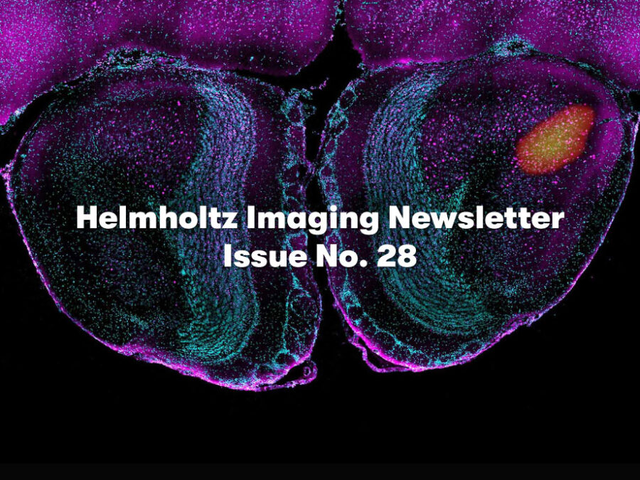 This image combines functional ultrasound imaging and high-resolution confocal microscopy to illustrate how specific stimuli activate the smell center in anesthetized mice. The highlighted brain region is the anterior olfactory nucleus (AON), a key part of the olfactory cortex involved in processing smells.