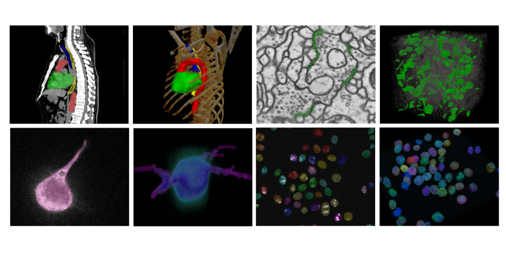 Collage of eight scientific images demonstrating different biomedical imaging and segmentation tasks.